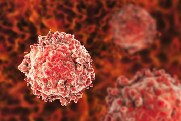 Los mitos sobre la leucemia que atentan contra el diagnóstico precoz