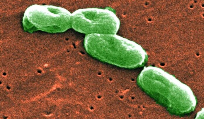 Investigadoras de la UNLP estudian formas de combatir la resistencia de bacterias desde su envoltura celular