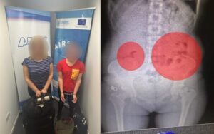 Ezeiza: detienen a dos “mulas” que llevaban cocaína en sus partes íntimas rumbo a Madrid