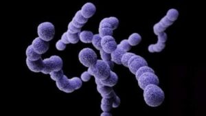 Salud investiga las causas de suba de casos y muertes por "clones hipervirulentos" del Streptococcus