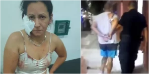 Avellaneda: cae el hombre que mordió a su pareja y le arrancó un pedazo de oreja
