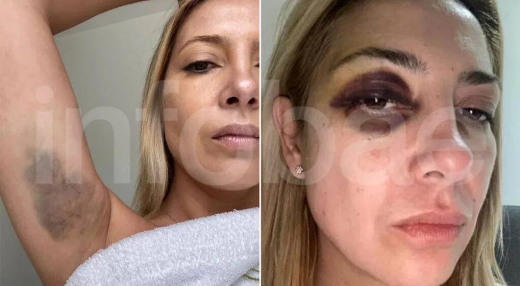 La exprimera dama, Fabiola Yañez, en fotos difundidas en las últimas horas. (Infobae)