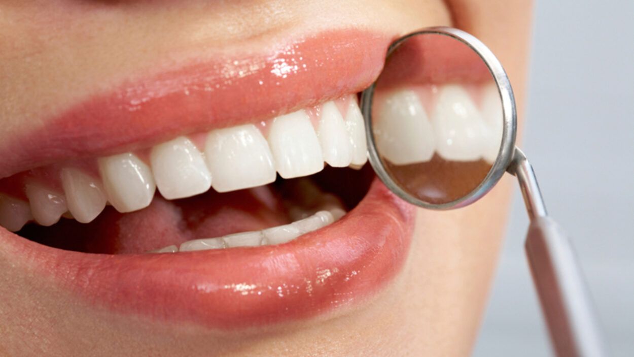 Cuanto cuesta implante dental en Argentina precios 2024